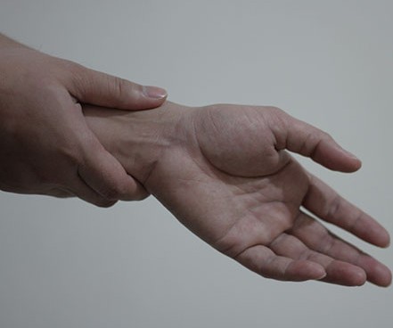 Rhizarthrosis