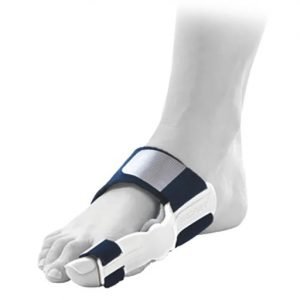 Hallux Valgus o juanate